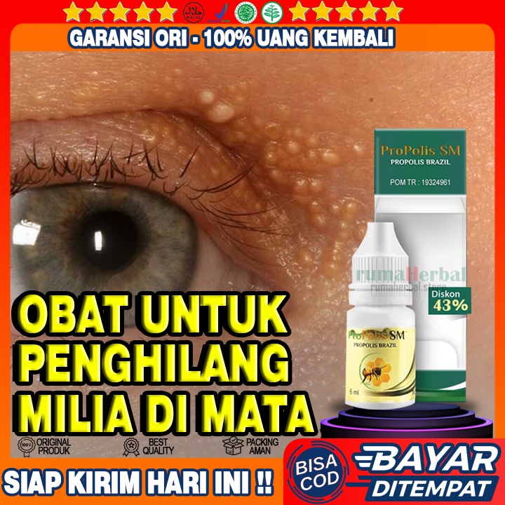 Obat Milia di Mata - 100% Propolis SM Brazil Asli Berkhasiat