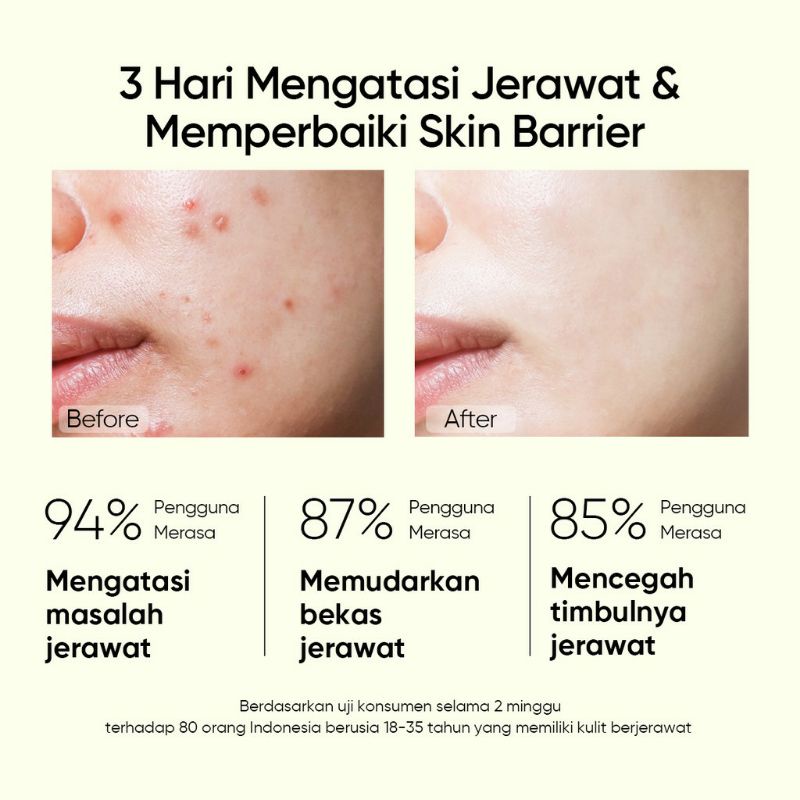 SKINTIFIC 2% SALICYLIC ACID Anti Acne Serum 20ml - Bebas jerawat dan noda hitam