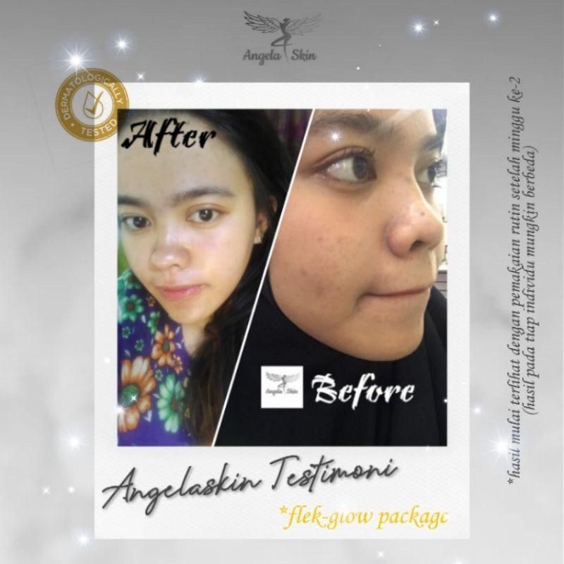 Angela Skin Whitening Premium
