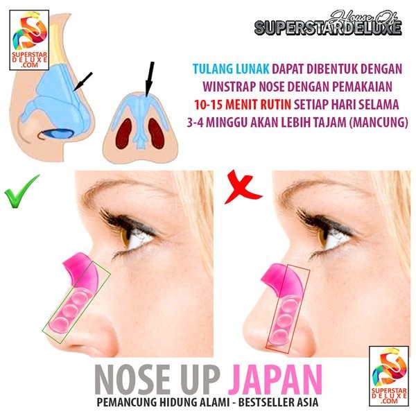 NOSE UP PEMANCUNG HIDUNG KLIP PENJEPIT HIDUNG ALAMI ALAT PEMANCUNG