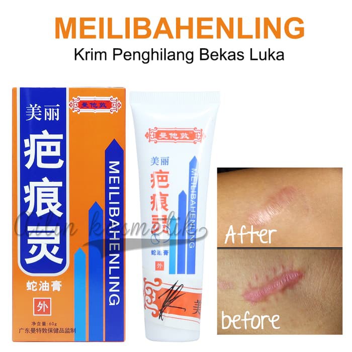MEILIBAHENLING