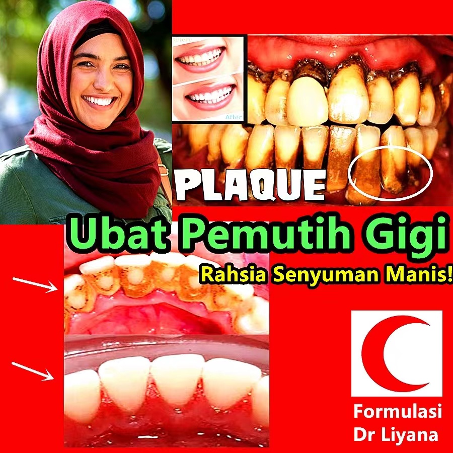Pasta gigi whitening Gigi putih Whitening toothpaste Pasta gigi pemutih gigi Odol pemutih gigi dan karang gigi Mousse Pemutih Gigi Pembersih Mulut Pasta Gigi Berbusa Nafas Segar Menghilangkan plak dan gigi berlubang