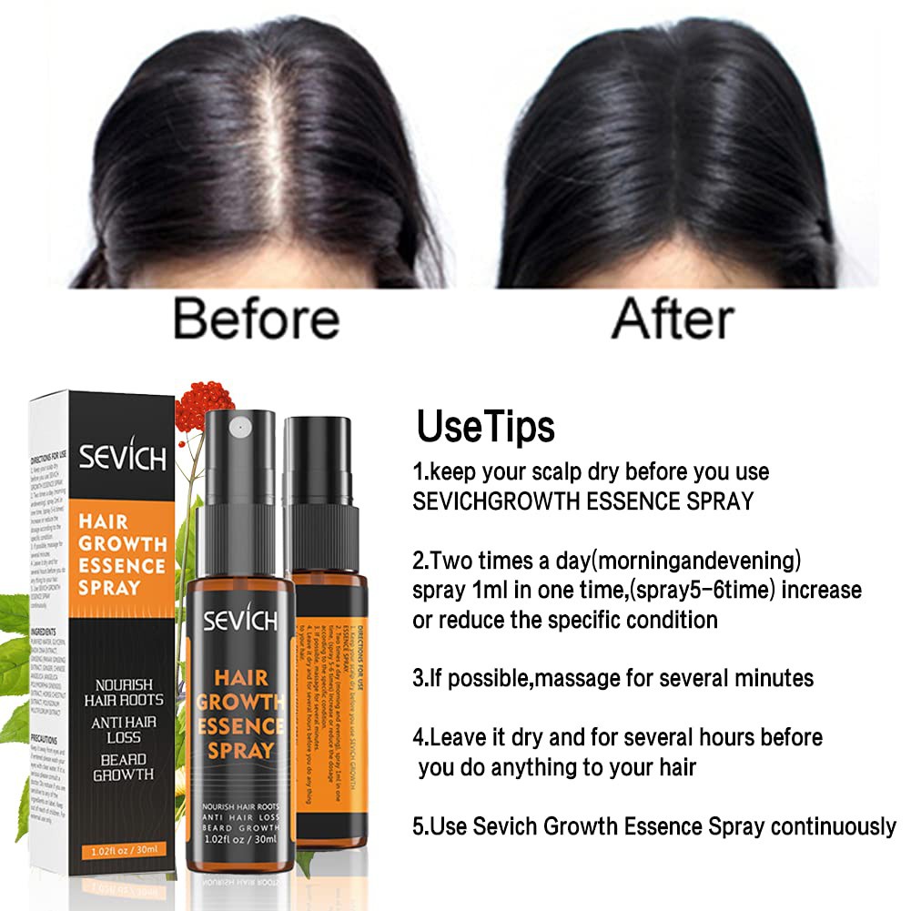 SEVICH HAIR GROWTH ESSENCE SPRAY  | PENUMBUH RAMBUT 30ml