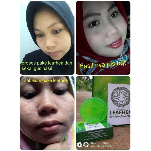 sabun muka merk LEAFHEA