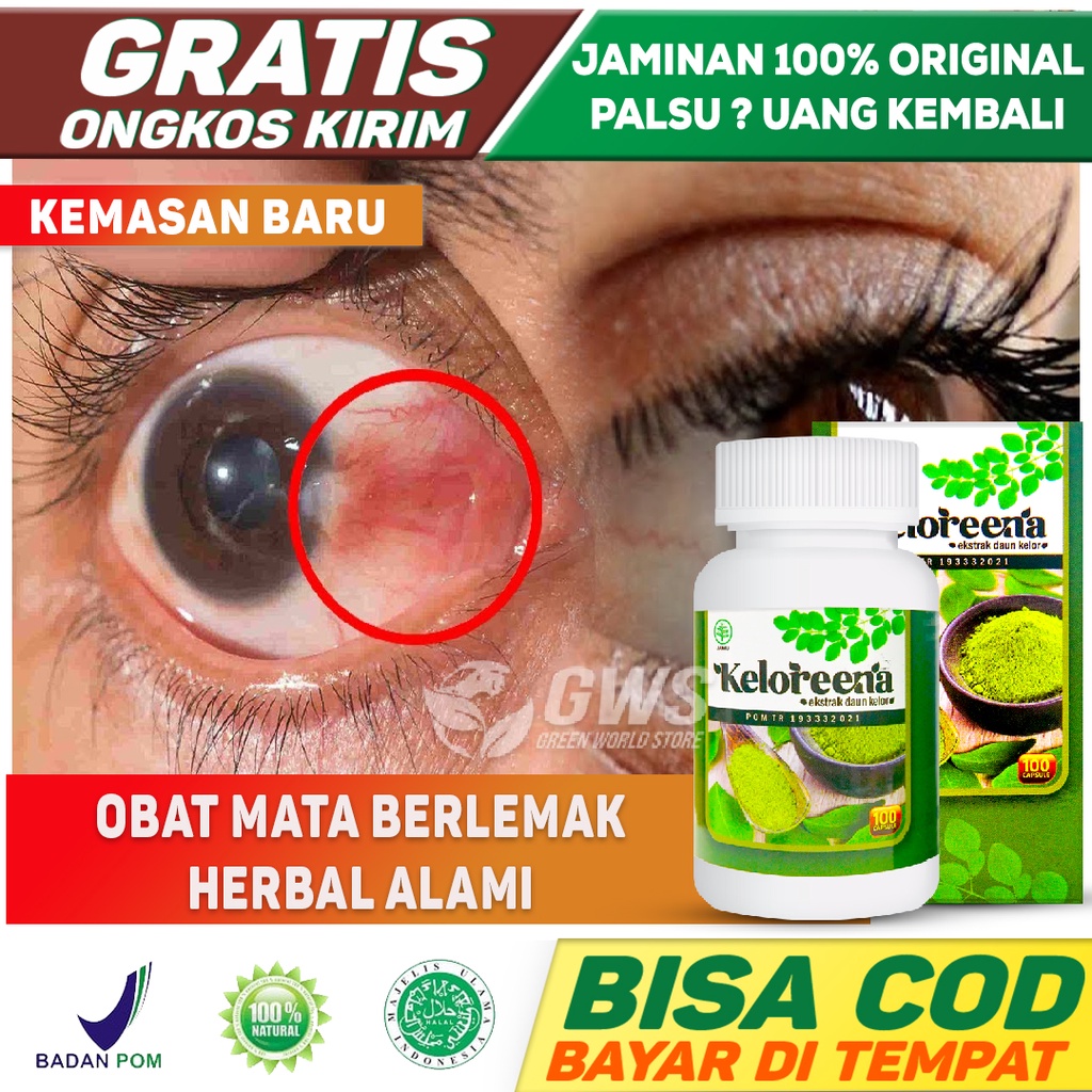 Jual Obat Mata Berlemak, Pembersih Pterigium, Pterygium, Penghilang ...