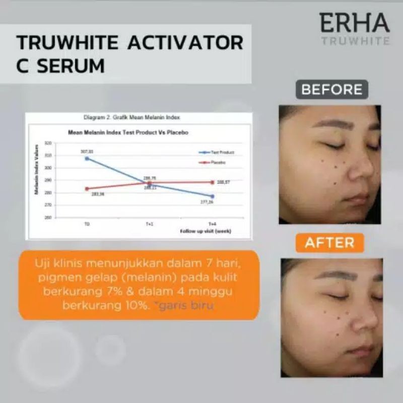 ERHA Truwhite Activator C Serum 20ml