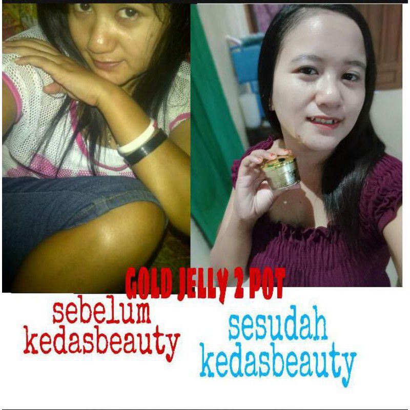 (READY STOK) GOLD JELLY KEDAS BEAUTY 100 % ORI + FREE GIFT-5