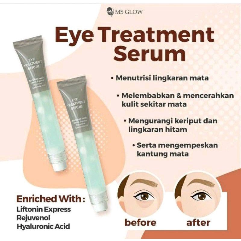 Ms glow eye treatment serum - serum untuk mata panda - ms glow original bpom
