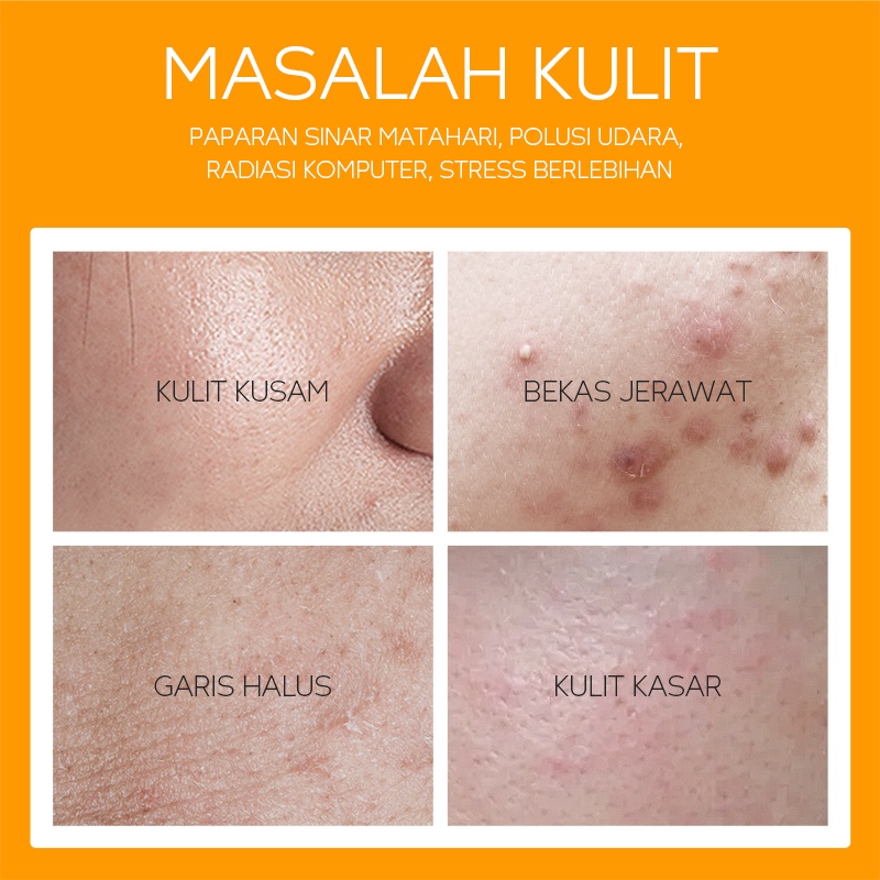 BPOM Fenyi Vitamin C Serum Mencerahkan Memudarkan Bintik Hitam Bekas Jerawat Anti Oksidan 17ml