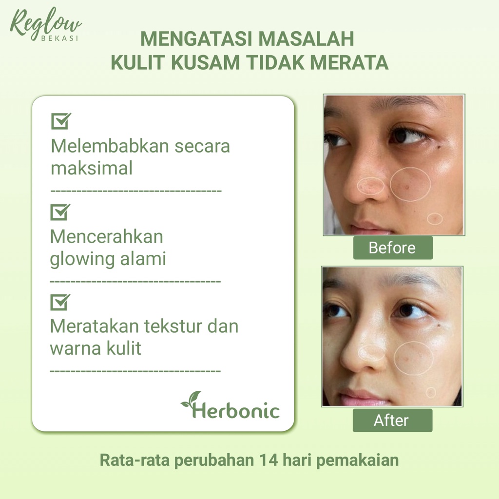 REGLOW Skincare Original BPOM Glowing Skin Treatment Paket Wajah Glowing Perawatan Kecantikan Pemutih Wajah Facial Wash Toner Cream Micellar Water Pembersih Wajah Penghilang Jerawat Flek Hitam Noda Hitam Bruntusan kerutan Inflamasi-6