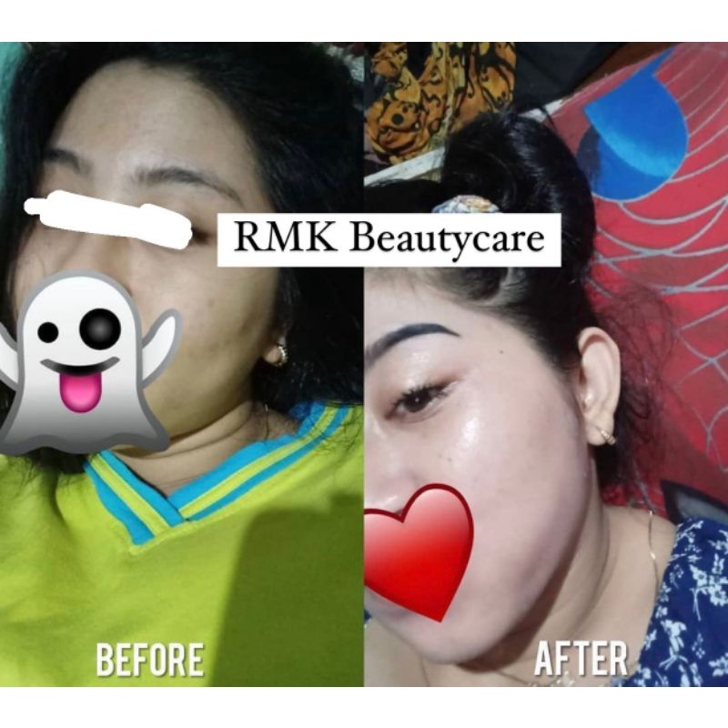 paket whitening BOOSTER / SENSITIF cream pemutih kulit kebal susah putih rmk / cream pemutih wajah kusam kering / kusam berminyak