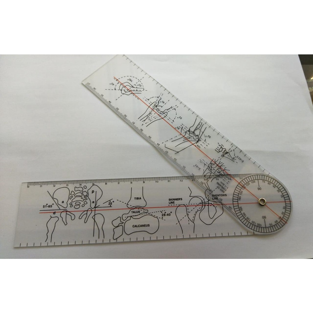 

Goniometer atau penggaris sudut untuk tangan