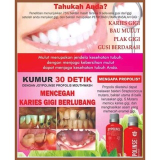 Joypolinse Obat Radang Tenggorokan Paling Ampuh Shopee Joypolinse Obat Radang Tenggorokan Paling Ampuh Shopee