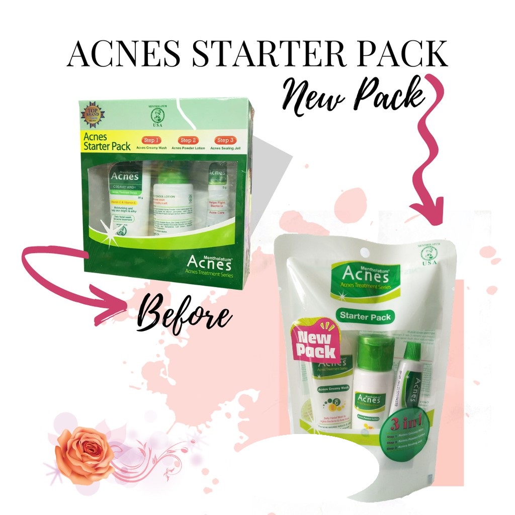 ACNES Starter Pack / Travel Size (Creamy Wash, Powder Lotion, Sealing Gel)