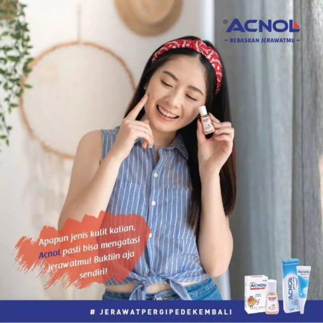 Medan Termurah Sangat ampuh Obat Jerawat Acnol Lotion