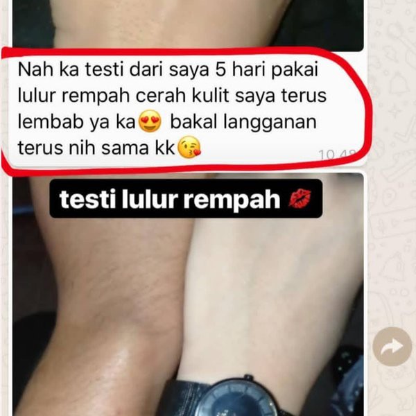 BODY SCRUB GLOW UP PEMUTIH BADAN BPOM ZURE BEAUTY / LULUR PEMUTIH BADAN BPOM