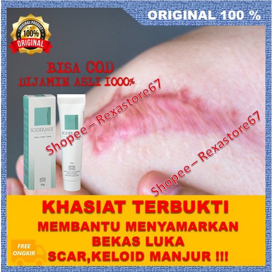 Sodermix Cream Menyamarkan Bekas Luka Scar Keloid Ruam Popok Ampuh ASLI