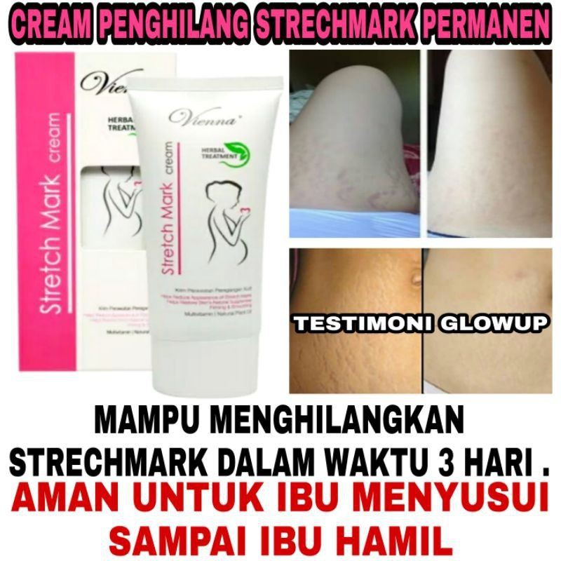 CREAM PENGHILANG STRETCH MARK VIENNA STRETCH MARK CREAM ORIGINAL BPOM - ANTI SELULIT