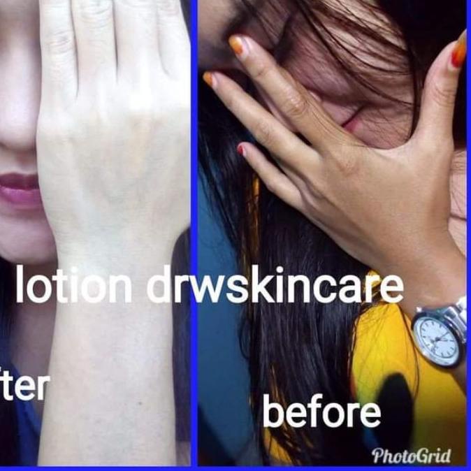 ✷ paket Lotion siang & Malam Drw Skincare Spesial ➩