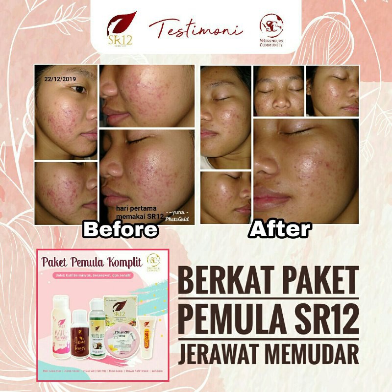 PAKET PEMULA SR12 KOMPLIT / PERAWATAN SKINCARE AMAN &amp; ALAMI / PENETRAL KULIT / PAKET PERAWATAN WAJAH