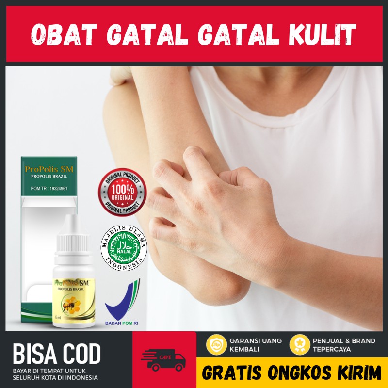 Obat Kulit Gatal Karena Jamur Biang Keringat Alergi Eksim Kering Gatal Karena Kucing - Propolis SM