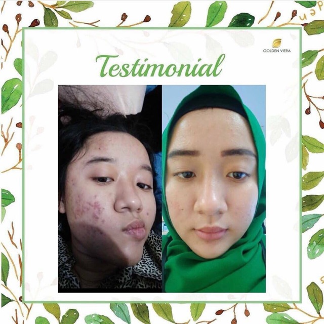 Golden Viera Herbal Soap Original Kemasan Baru Bebas Pilih Hadiah