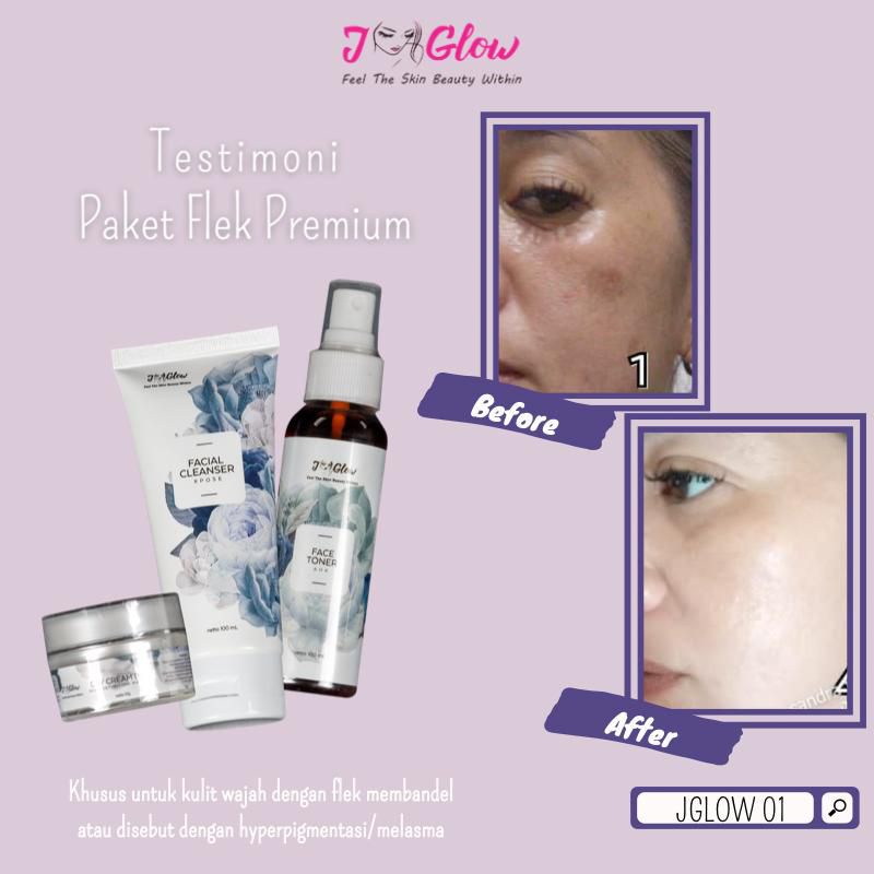 JGLOW - PAKET FLEK PREMIUM