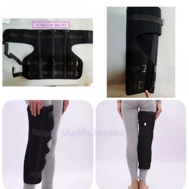 Deker kaki sendi lutut fraktur ligamen
