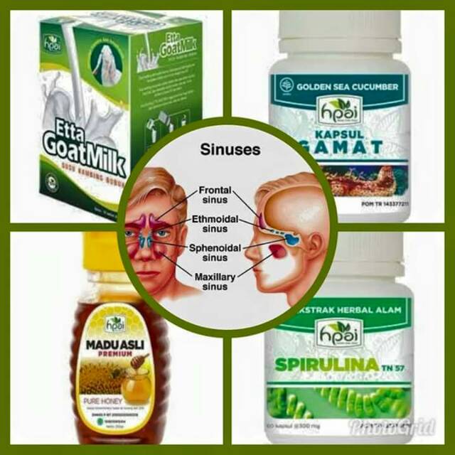 Paket Obat Sinusitis Obat Herbal Hpai Shopee Indonesia