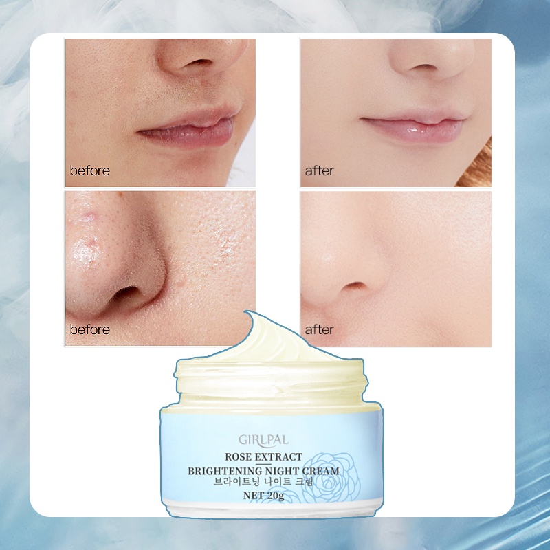 GIRLPAL 20g Rose Brightening Cream Vitamin C + Niacinamide Day &amp; Night Brightening Moisturizing Skin Cream GPSRF1004 GPSRF1005