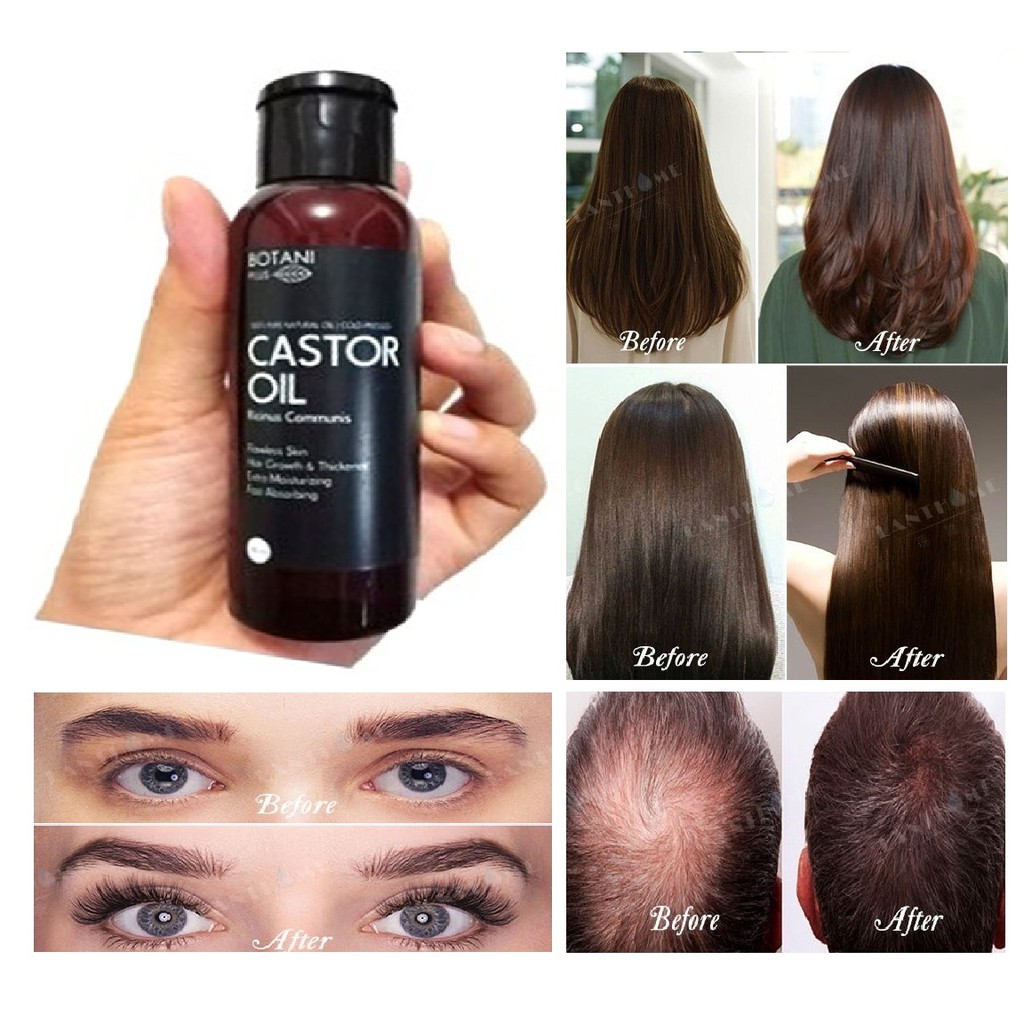 Magic Castrol Oil Sip Penumbuh Rambut, Bulu Mata Mengatasi Rambut Rontok, Lepek, Kering, Botak