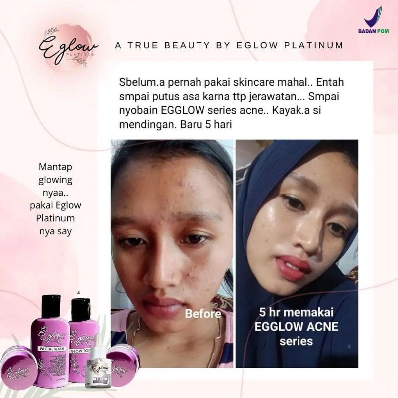Paket Eglow platinum/ Eglow platinum/EGLOW