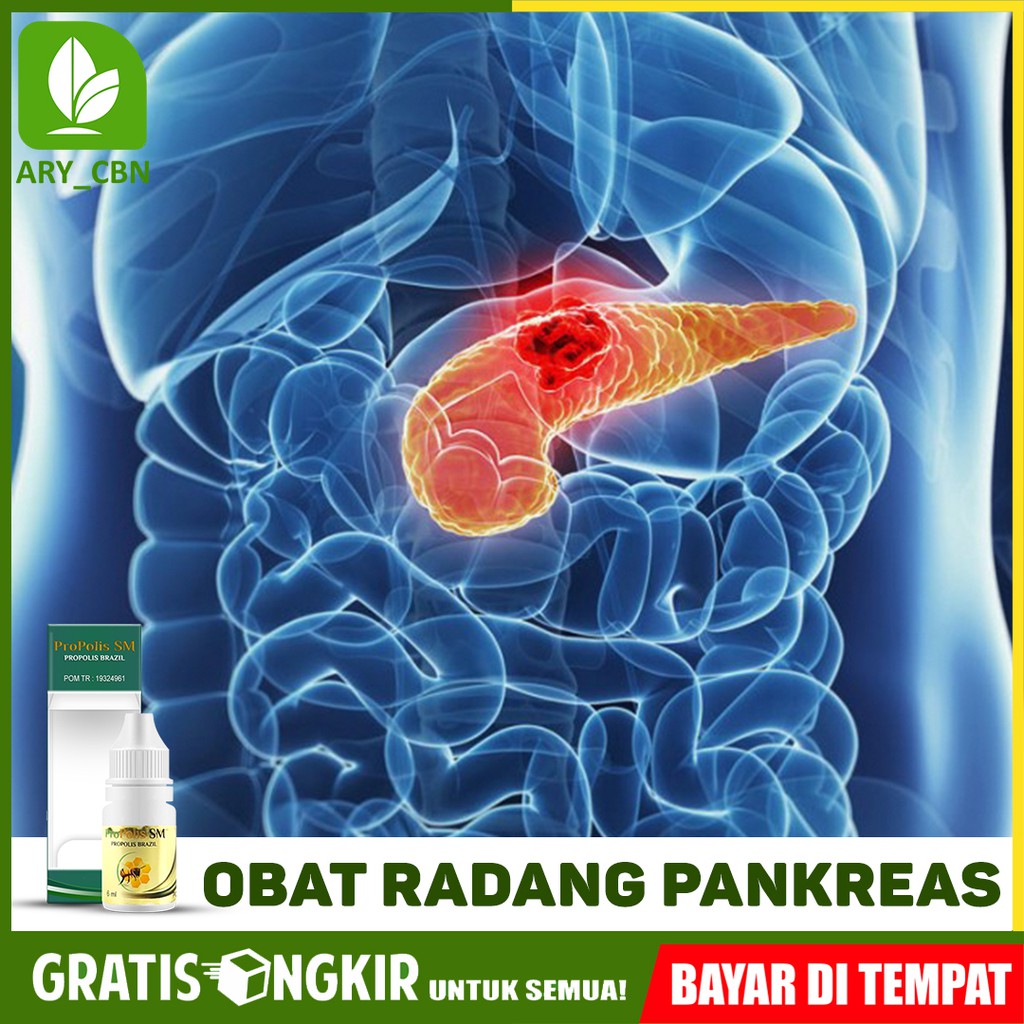 Obat Radang Pankreas Pankreatitis Akut, Nyeri Bagian Perut Propolis SM Brazil Di CIREBON Bisa COD