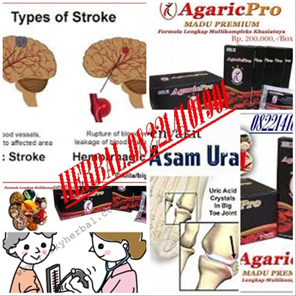 Penyakit Asam Urat Kronis Obat Agaricpro Terbukti Ampuh Dan Berkhasia Shopee Indonesia