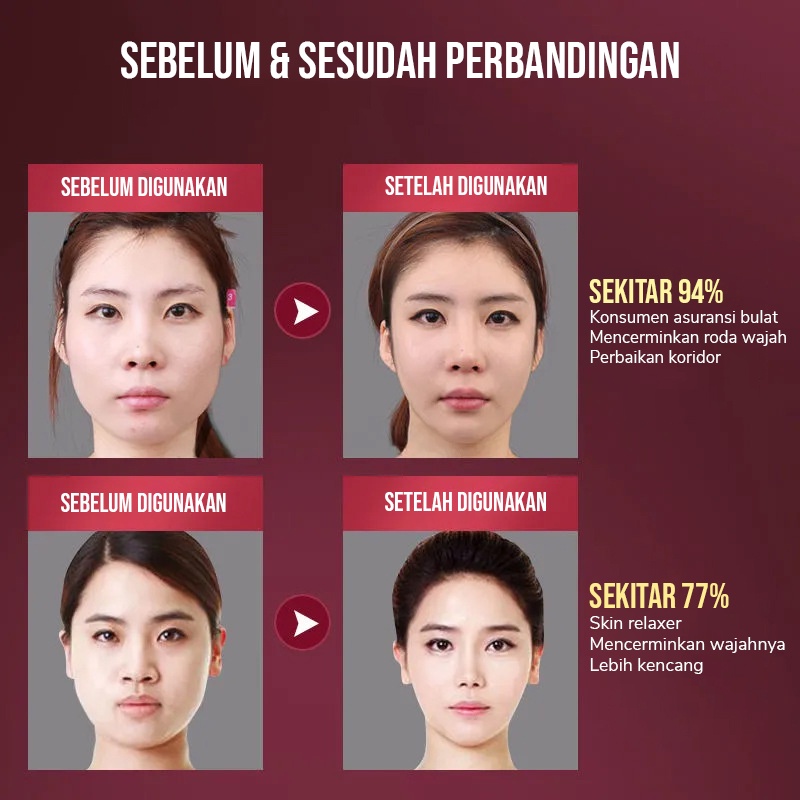 CJVS-SFE TINO Vshape Slimming Face Electric Penirus Pipi Wajah Dagu Dengan 5 Mode Getaran/alat penirus pipi wajah