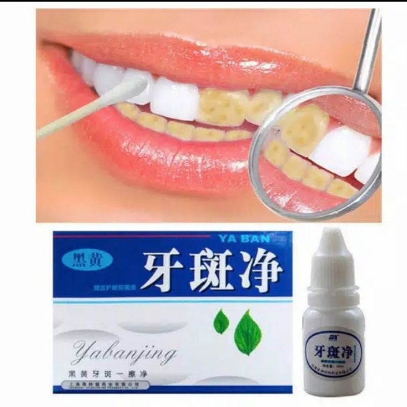 YABANJING UNTUK PEMUTIH GIGI 10ML / YABANJING WHITENING TEETH