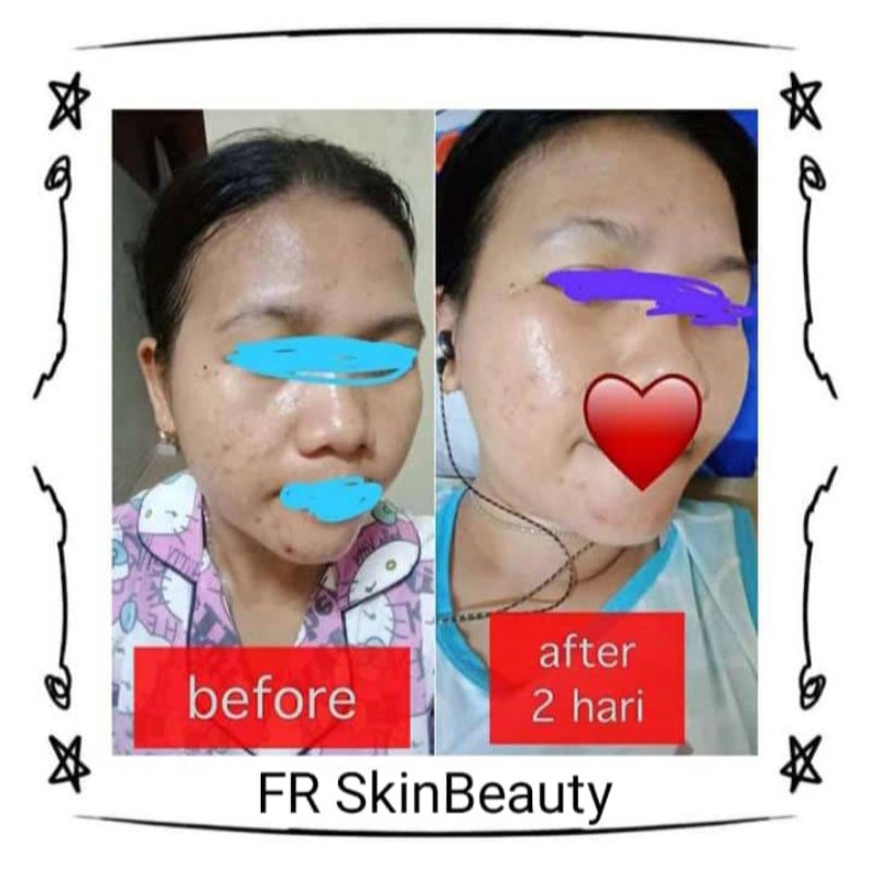 Paket Glow FR Skin Beauty