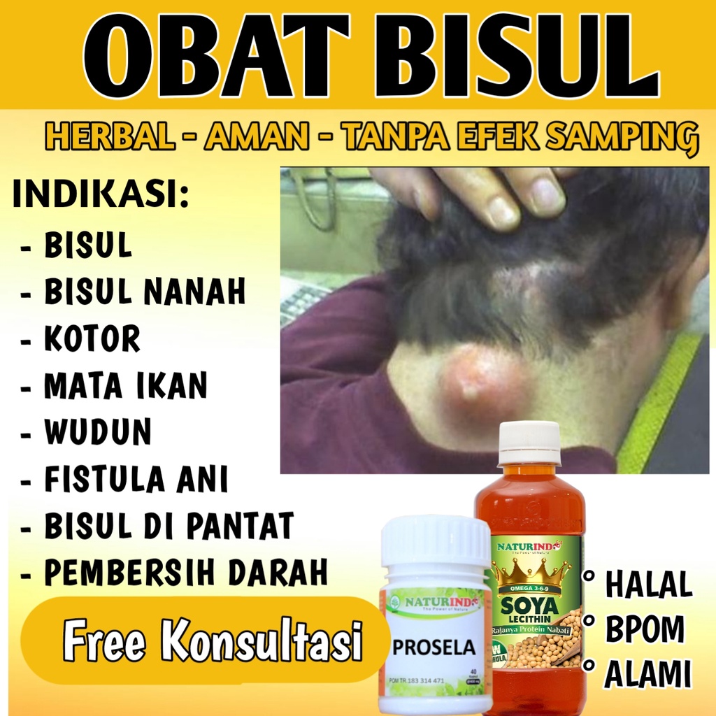 Jual Obat Bisul Darah Kotor Herbal Mata Ikan Di Pantat Jari Kaki Bisulan Paling Ampuh Naturindo Bpom Cod Indonesia Shopee Indonesia