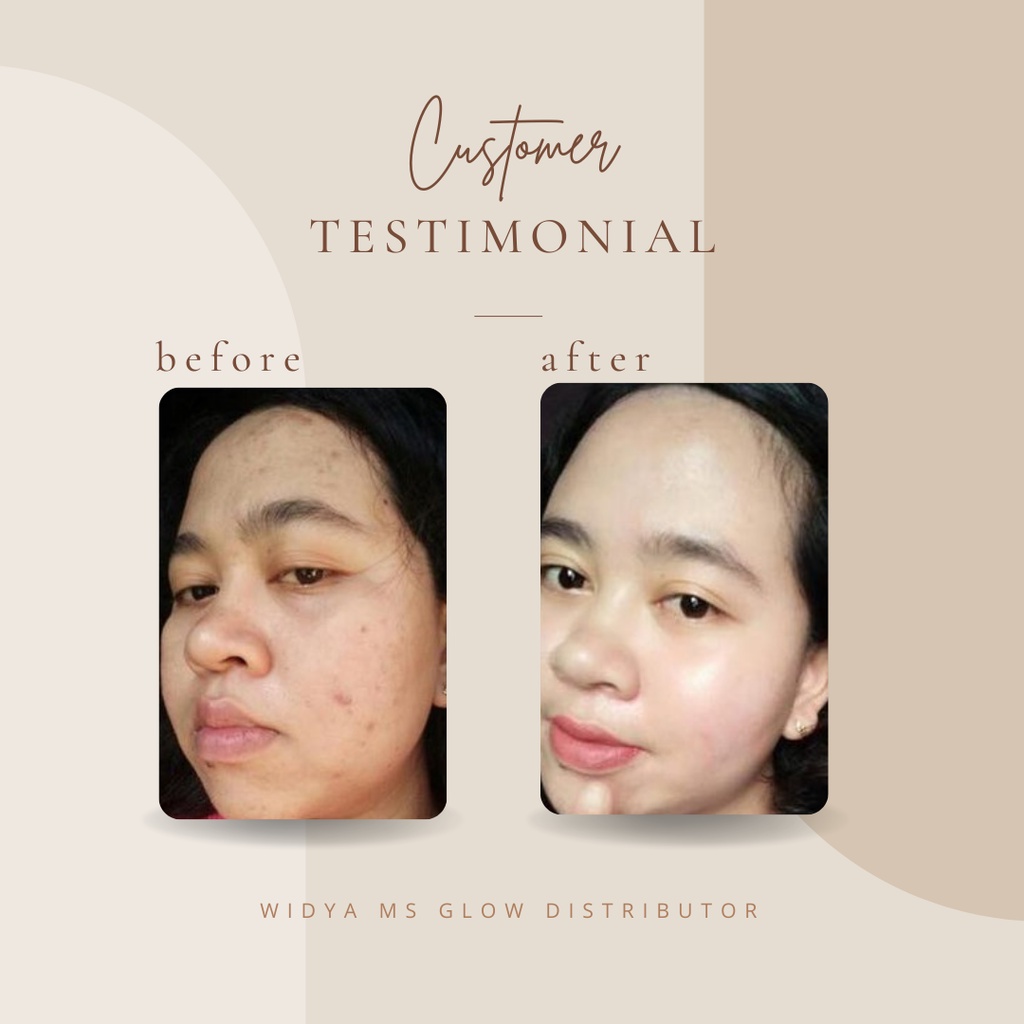 Ms Glow Luminous Luminous Paket Series Paket Luminous Free Dte / Flek Hitam / Kusam