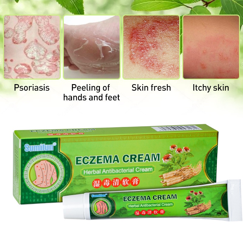 eczema cream salep eksim herbal antibacterial cream