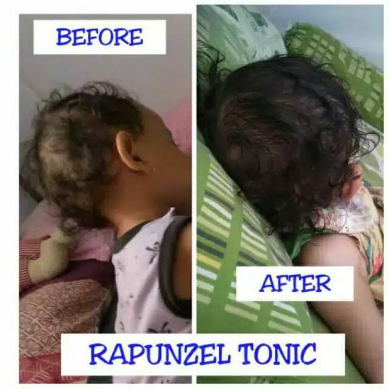 RAPUNZEL Hair Tonic Essential Oil Blend Varian Rambut Normal 100ml (ANTI BOTAK)