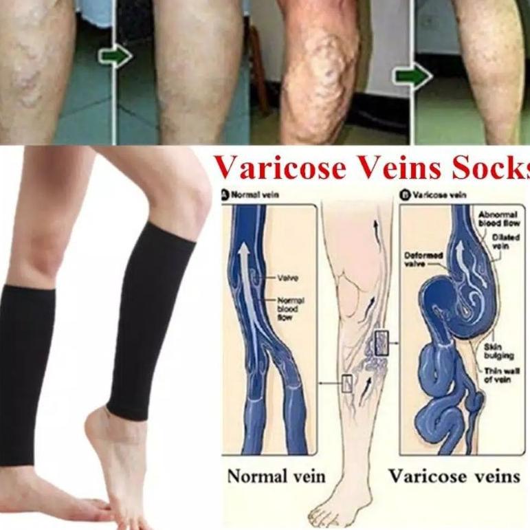 korset lengan pelangsing lengan korset lengan magnetic korset paha korset betis korset kaki - TMG.11