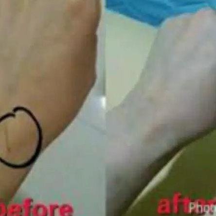 Sale!!! Peeling Gel 30% - Peeling Badan Bergaransi