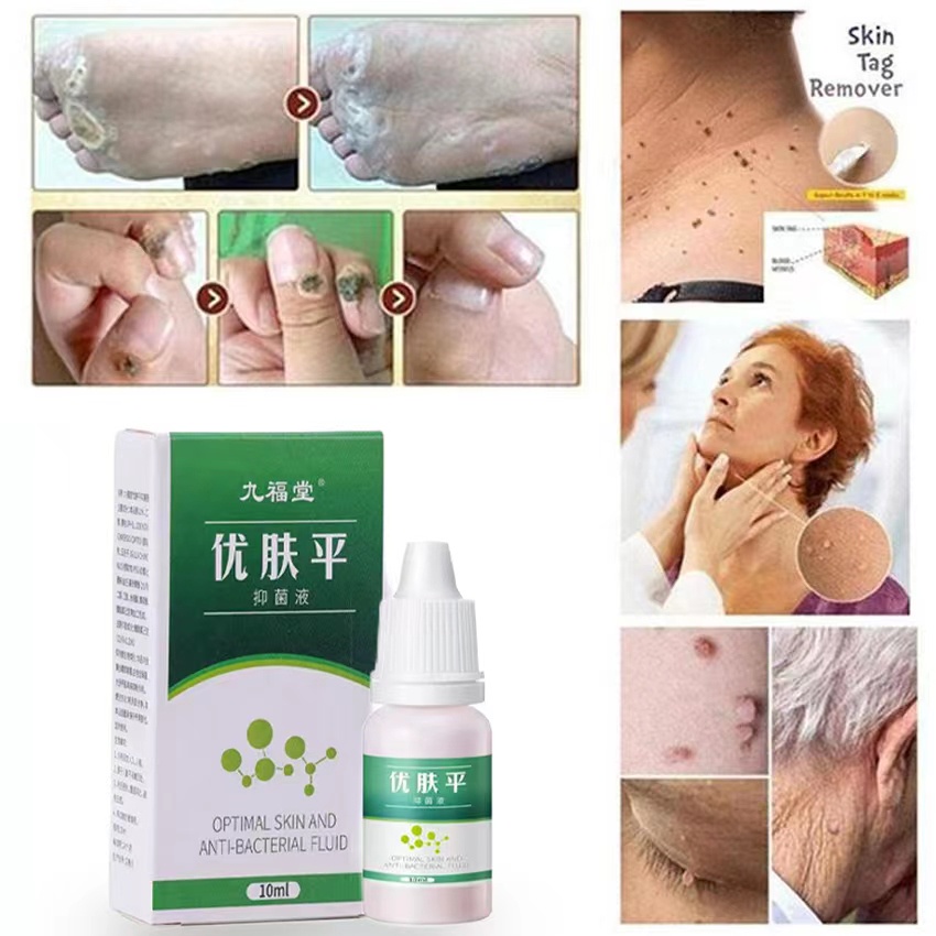 Cairan Obat Untuk Kutil Salep Untuk Kapalan Kaki Cairan Anti Kutil Tangan Dan Kaki Menghilangkan Kutil &amp; Skin Tag Cairan Antibakteri Obat Kutil 10ml Kapalan Di Tangan Dan Kaki Krim Antibakteri Penghilang Tahi Lalat