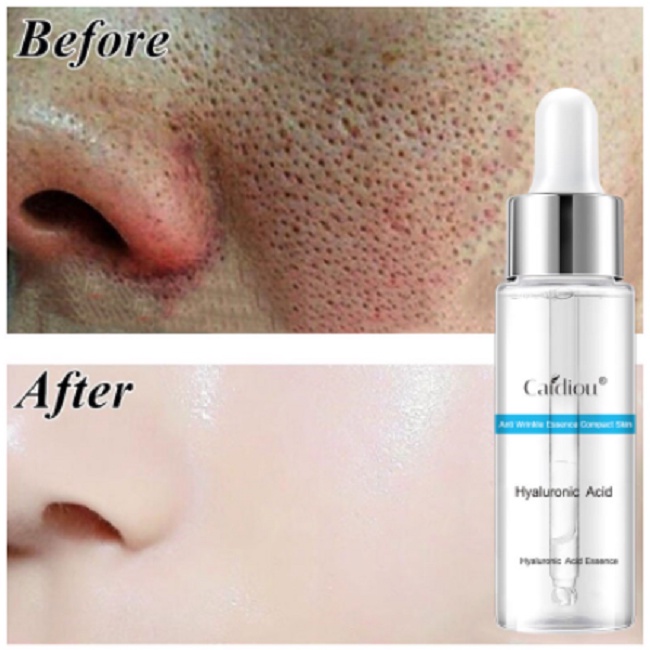 100% Original Serum Skin Care Oedo Anti Aging Face - Caidiou