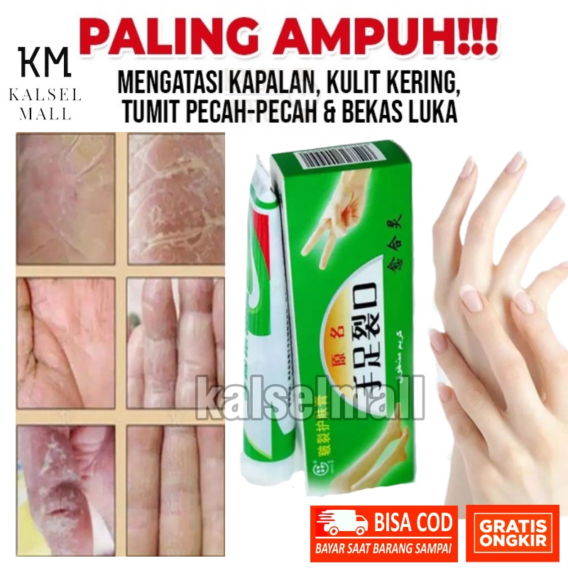 Cream Salep Obat Krim Original 100% AMAN AMPUH Salap Tumit Kaki Tangan Pecah Pecah Tumit Ampuh Kering Kulit Tebal Mengelupas Bekas Luka Kapalan Mengelupas  Kapalan Kering Tebal Rayapan Kasar OC3