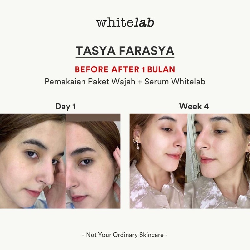 WHITELAB Brightening Paket Wajah Serum + Night Cream + Day Cream + Facewash + Toner