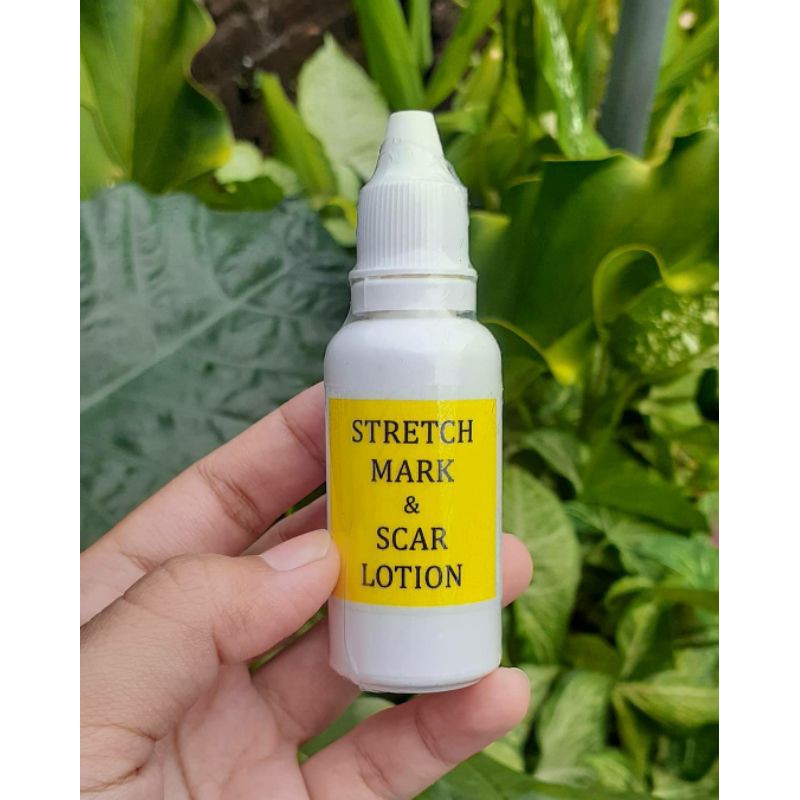 Strechmark Lotion Ampuh / Penghilang Strechmark