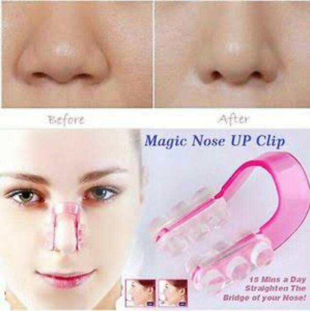 NOSE UP CLIPPER PEMANCUNG HIDUNG INSTAN