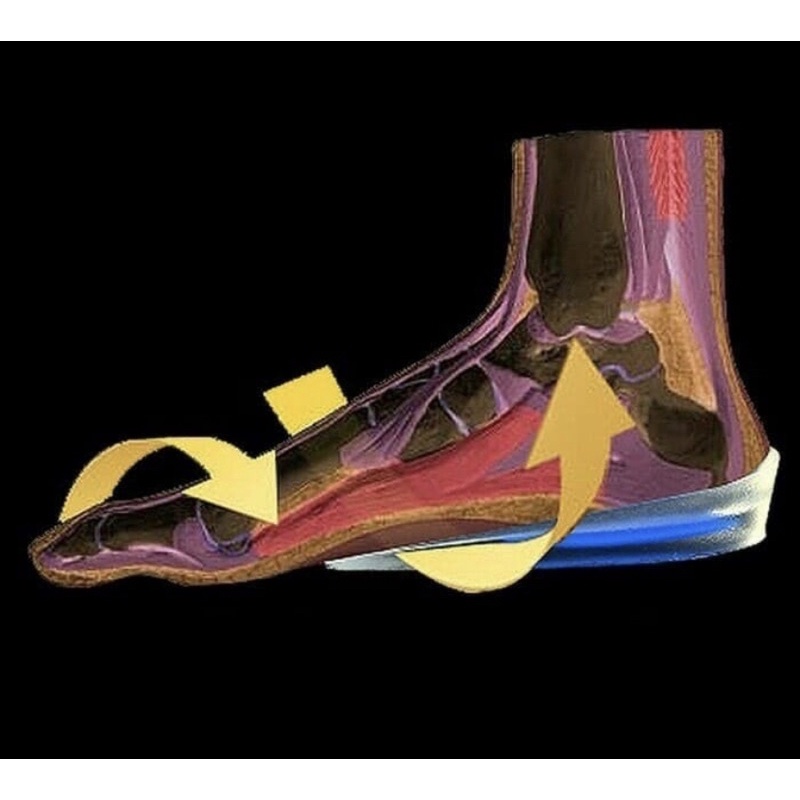 Insoles Gel Alas Tumit Plantar Soft Silikon Gel Half Heel Spur Pain Man 1 Pasang - Insole Terapi